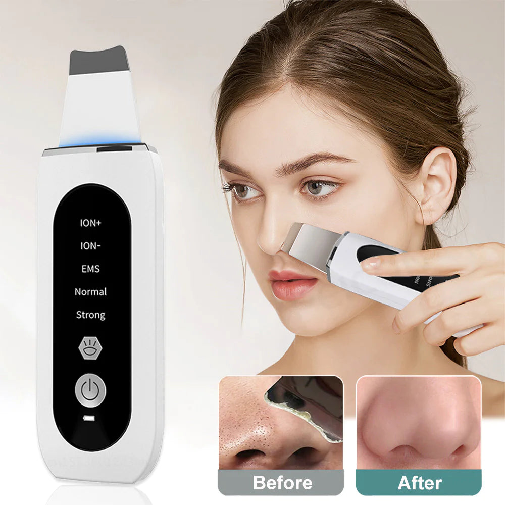 Ultrasonic Blackhead Remover